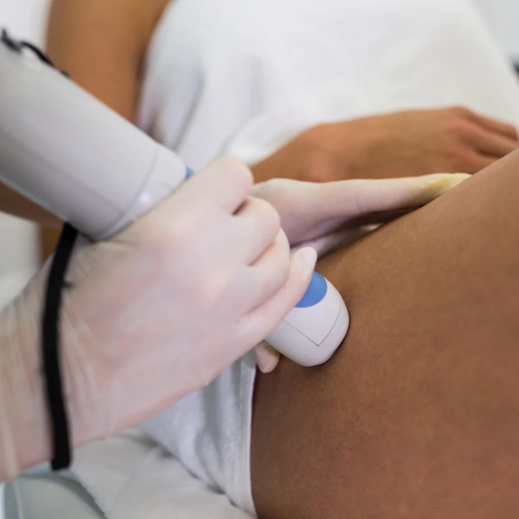 Liposucción Radiofrecuencia