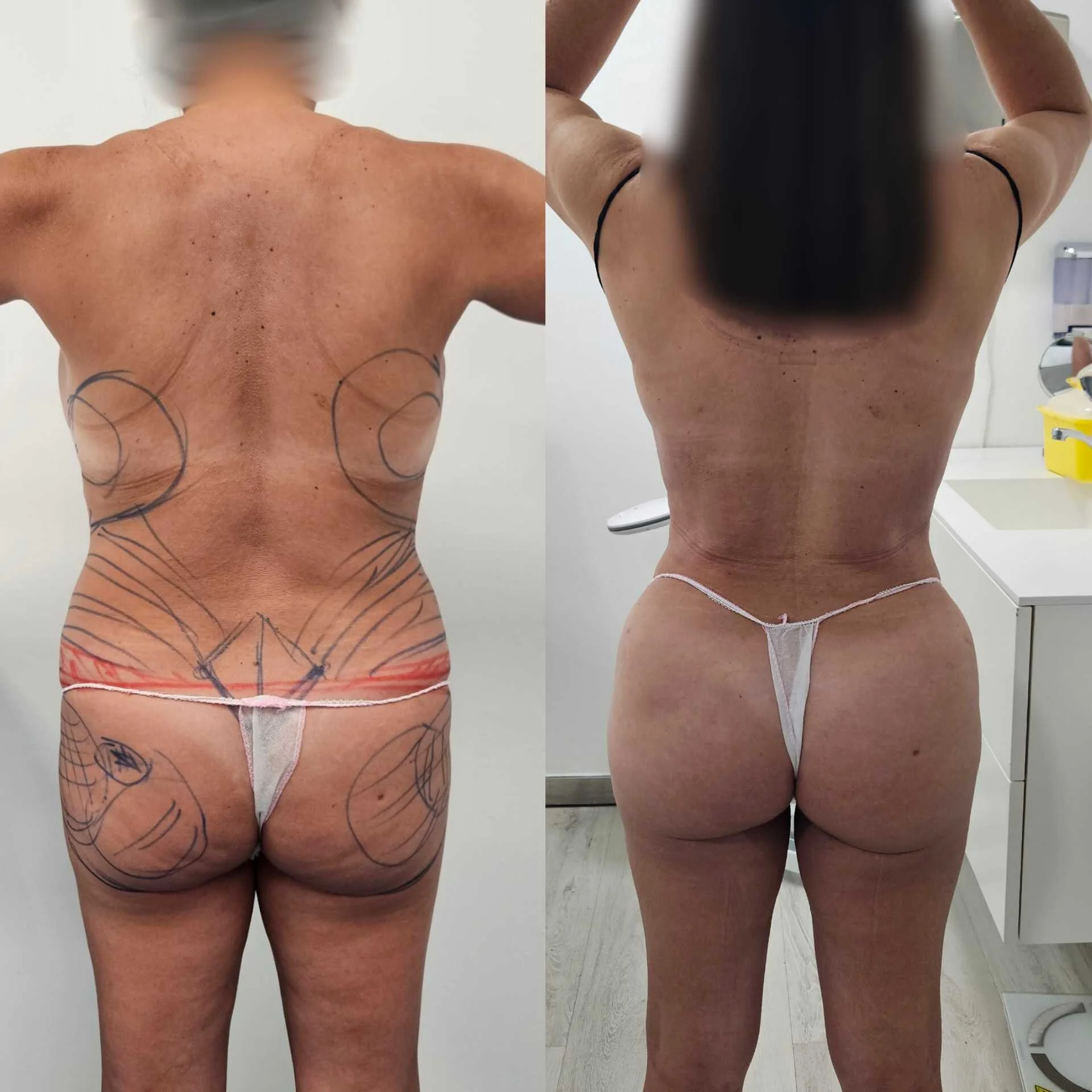 Antes y después